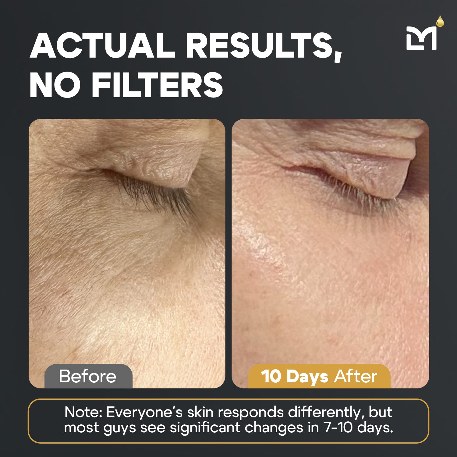 Titan Golden Skincare Kit