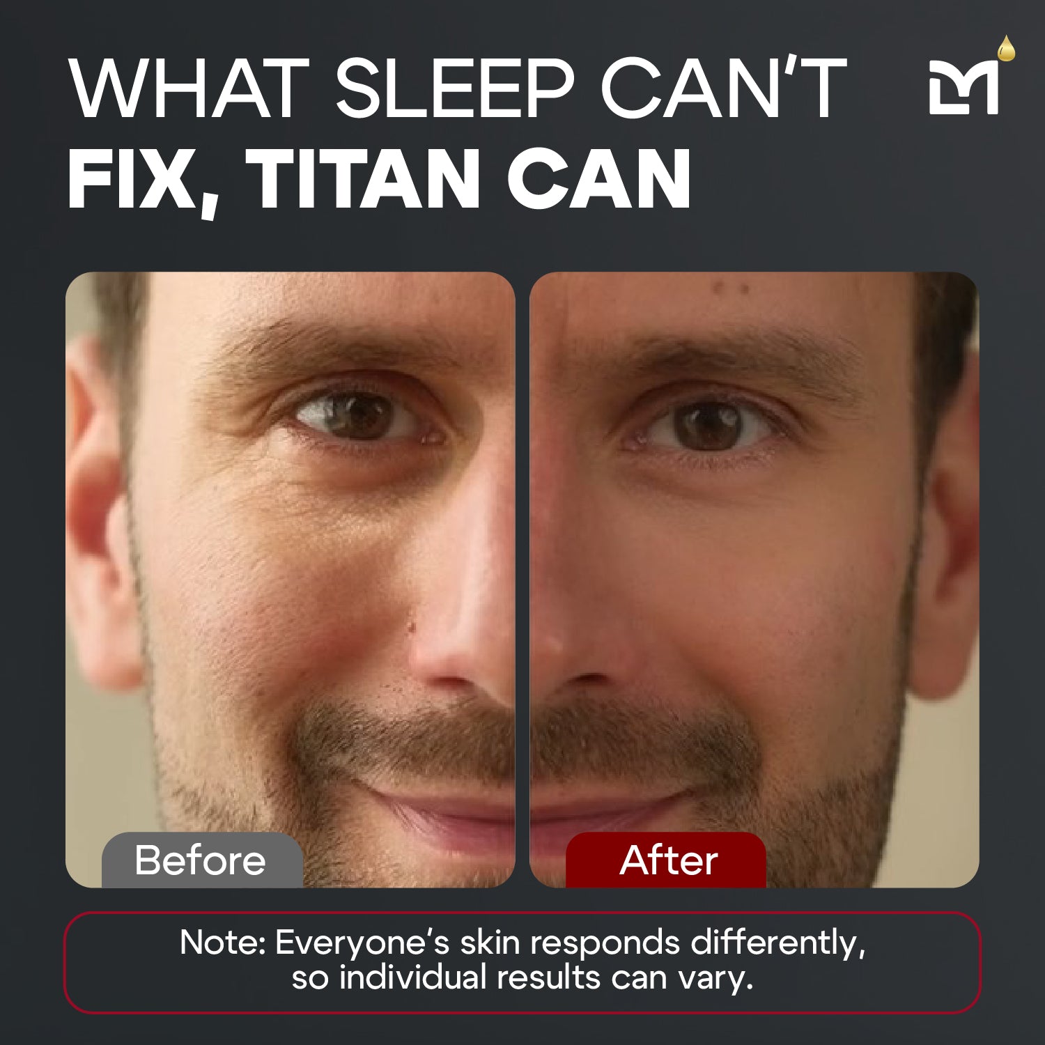 Man Labs Titan Peptide Eye Gel | High potency | Anti-aging | Anti-puffiness | 15 mL image 5